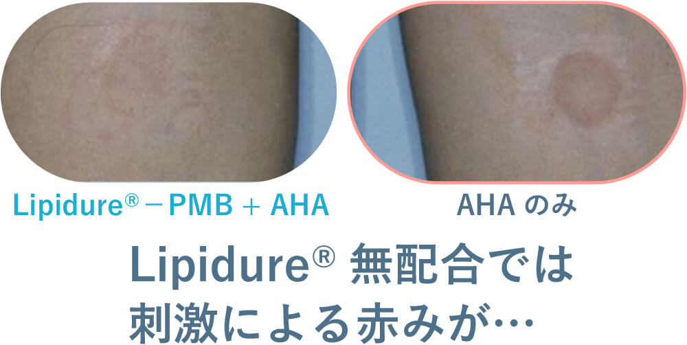 Lipidure®無配合では刺激による赤みが…