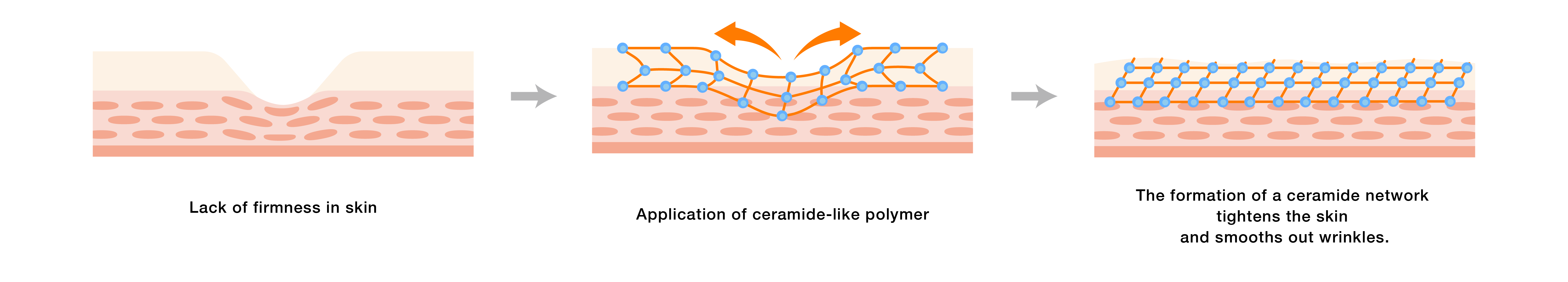 This is a diagram of the skin’s surface before and after applying a ceramide-mimetic polymer. When applying the ceramide-mimetic polymer to skin lacking firmness, a ceramide network forms on the skin’s surface, smoothing out wrinkles.
